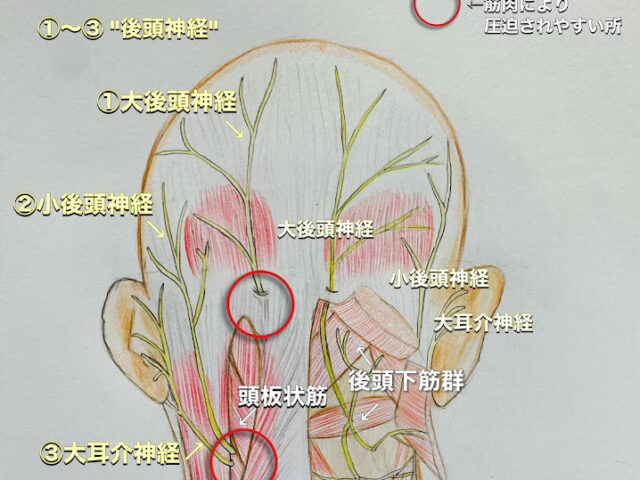 頭痛(後頭神経痛)について