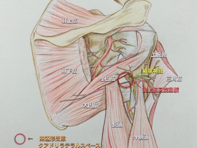 四辺形間隙症候群（腋窩神経麻痺）とは