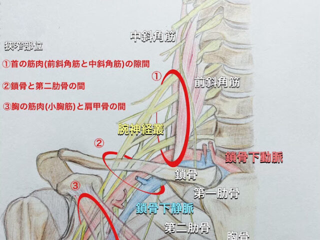 胸郭出口症候群とは