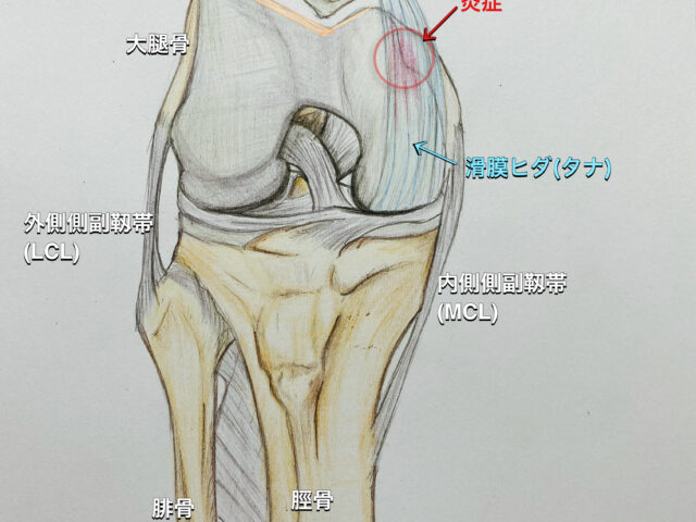 タナ障害とは！？